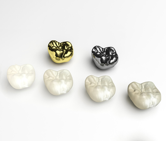 dental crowns near you