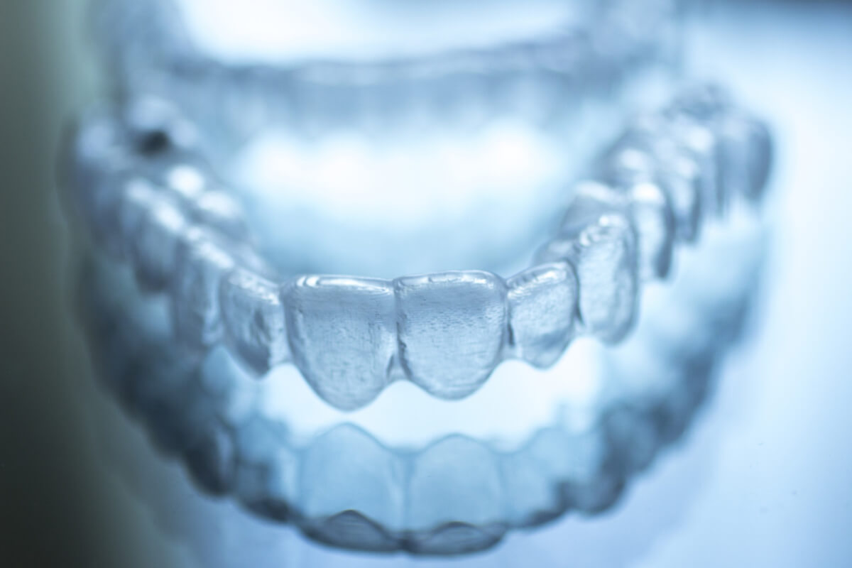 things to know before getting invisalign in grand prairie