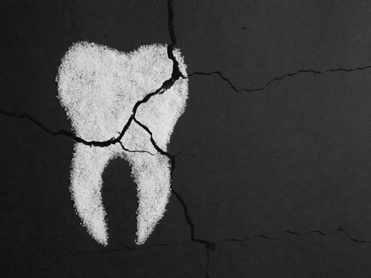 the long-term effects of ignoring a cracked tooth