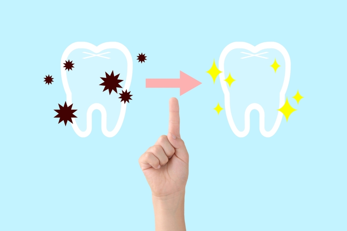 5 ways to prevent cavities between dental visits in grande prairie