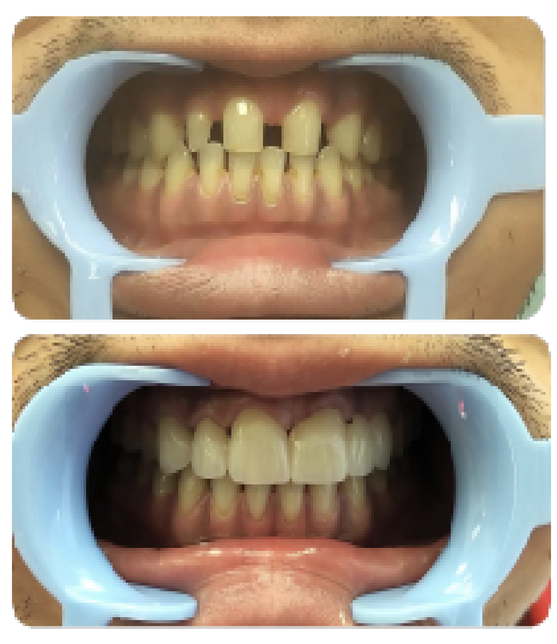 swanavon dental clinic in grande prairie