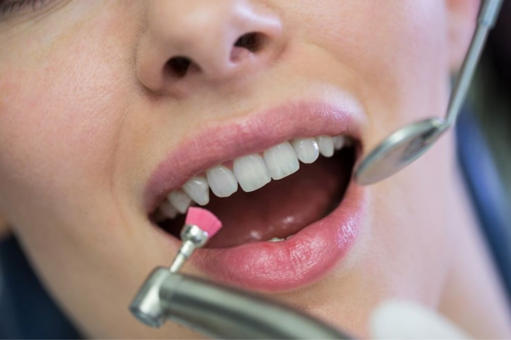 Whitening Toothpaste: What It Can and Cannot Do for Your Smile
